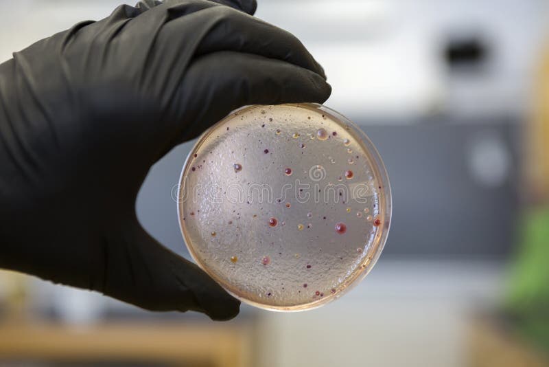 Bacterias que crecen en una placa del peri