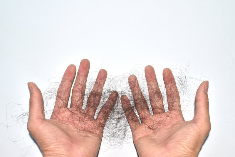 Bad Combing Causes Hair Damage Hair Loss Problems are Many Stock Photo