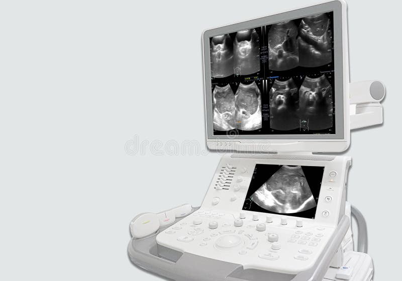 Badanie ultrasonograficzne całego jamy brzusznej, z obecnością ciała i antrum, z zwężeniem jamy ustnej Wątroba,GB,CBD,trzustka,śl zdjęcia stock Badanie ultrasonograficzne całego jamy brzusznej, z obecnością ciała i antrum, z zwężeniem jamy ustnej Wątroba,GB,CBD,trzustka,śl zdjęcia stock