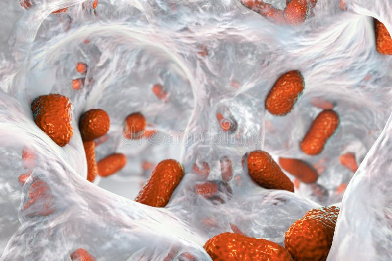 Bakterien-Acinetobacter baumannii innerhalb des Biofilm lizenzfreie abbildung Bakterien-Acinetobacter baumannii innerhalb des Biofilm lizenzfreie abbildung
