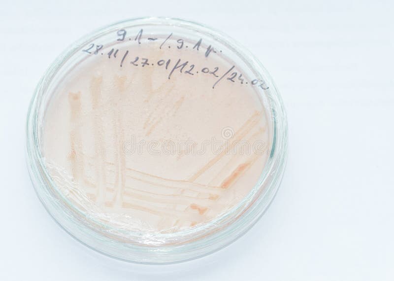 Petri dish with Rhizobium culture. Petri dish with Rhizobium culture