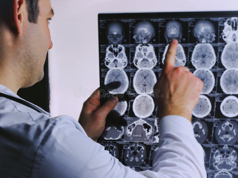Balayage de CT du cerveau Image de rayon X du cerveau Docteur, regardant la radiographie d'une tomographie d'ordinateur sur un ne photos stock Balayage de CT du cerveau Image de rayon X du cerveau Docteur, regardant la radiographie d'une tomographie d'ordinateur sur un ne photos stock