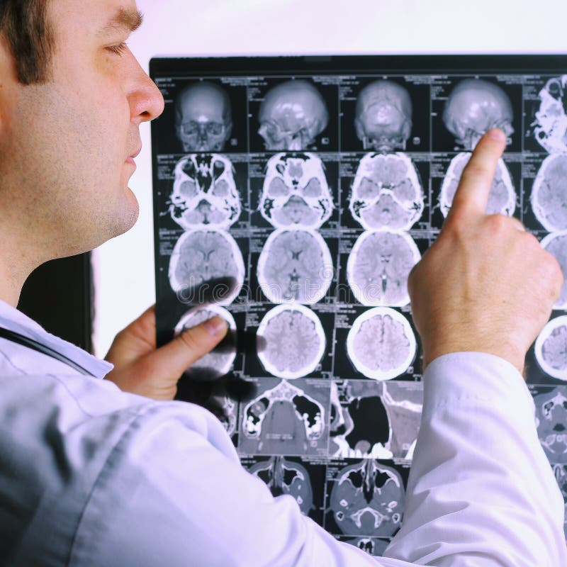 Balayage de CT du cerveau Image de rayon X du cerveau Docteur, regardant la radiographie d'une tomographie d'ordinateur sur un ne image libre de droits Balayage de CT du cerveau Image de rayon X du cerveau Docteur, regardant la radiographie d'une tomographie d'ordinateur sur un ne image libre de droits
