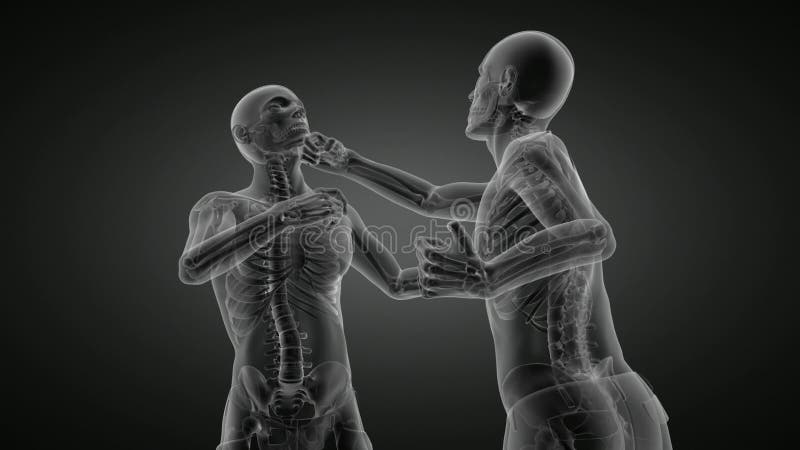 Radiographie d'hommes pratiquant le Loop Boxing illustration stock