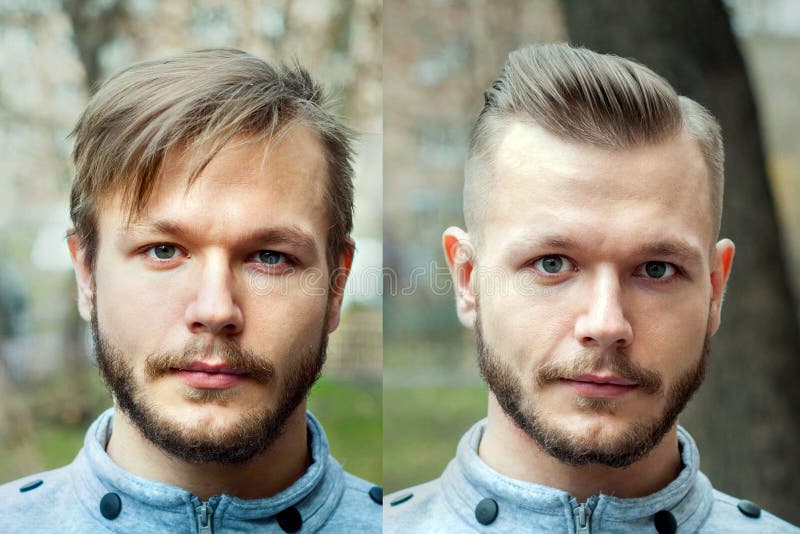 Bald Guy before after Haircut Concept for a Barber Shop: the Problem Man of  Hair Loss, Alopecia, Transplantation Stock Photo - Image of hairdo,  haircutter: 185388152