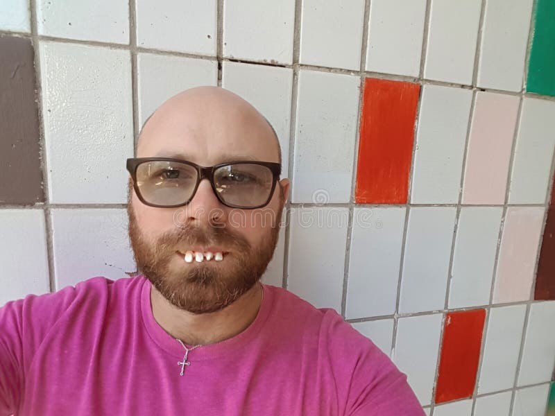 Bald Man in Eyeglasses with Ugly Teeth Stock Photo - Image of lifestyle, crooked: 134457514 Bald Man in Eyeglasses with Ugly Teeth Stock Photo - Image of lifestyle, crooked: 134457514