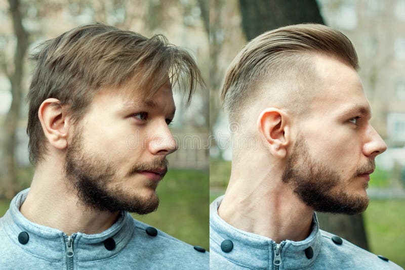 Bald Man before after Haircut Concept for a Barber Shop: the Problem Man of Hair  Loss, Alopecia, Transplantation, Side Stock Image - Image of shirt, face:  185388199