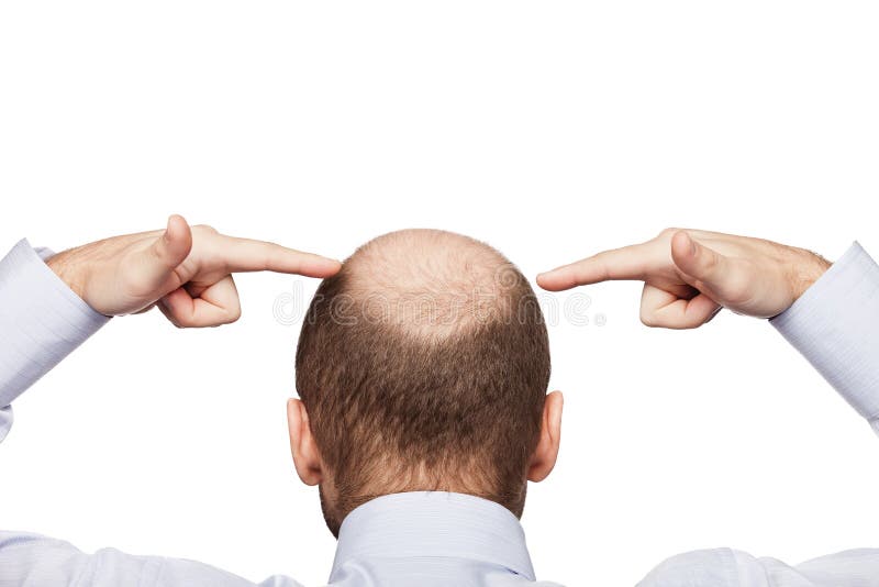 Bald man head stock image Bald man head stock image
