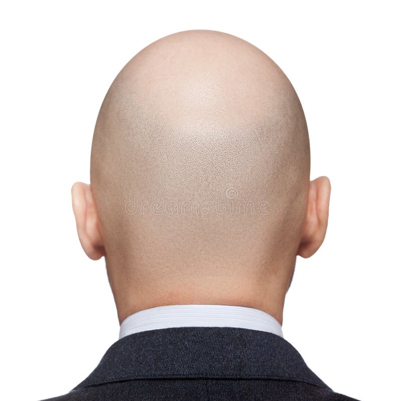 Bald Man Head Stock Image Image Of Healthcare Aging 24260121