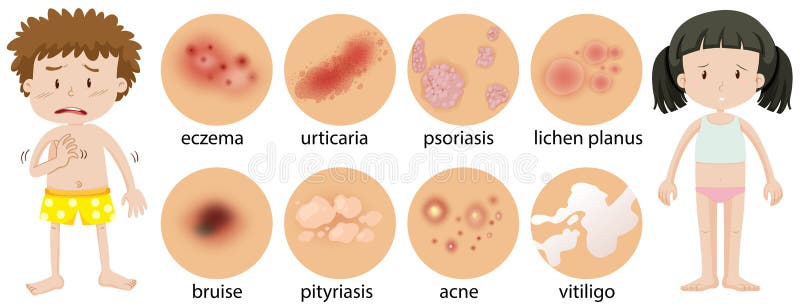 Bambini piccoli con differenti condizioni della pelle royalty illustrazione gratis Bambini piccoli con differenti condizioni della pelle royalty illustrazione gratis