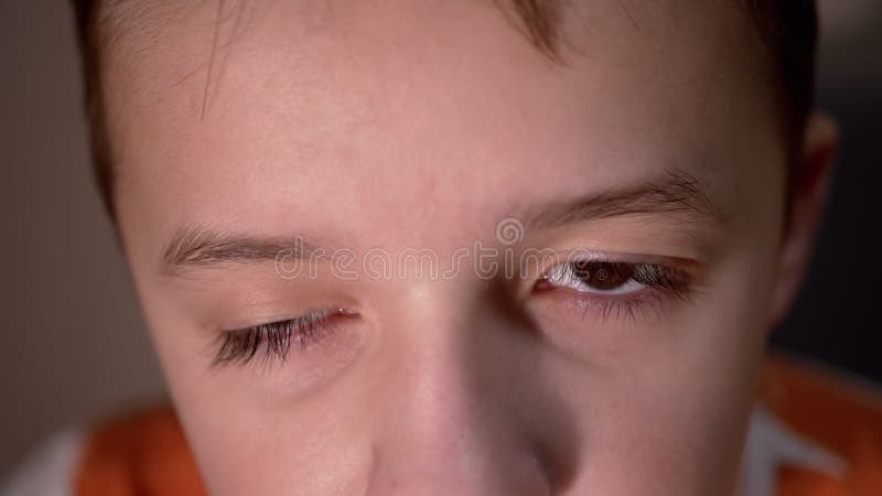 Bambino con ptosi della palpebra superiore per frustate lunghe. miopia. apertura e chiusura degli occhi