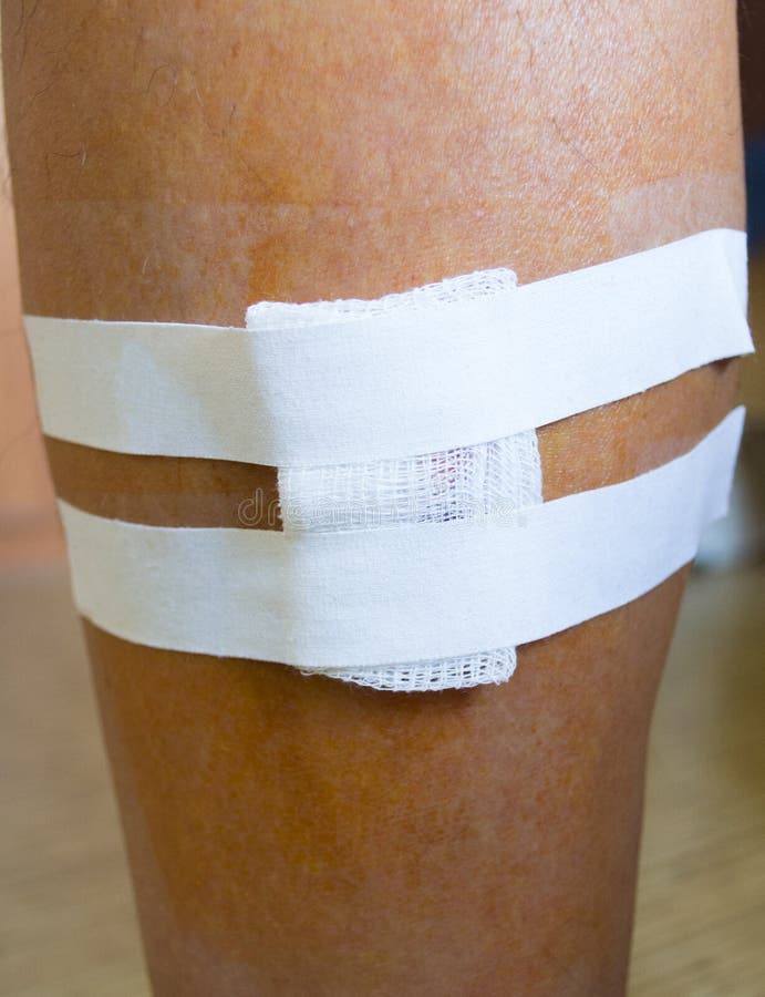 Leg Wound And Bandage Stock Photo Image Of Protection 2798622 leg-wound-and-bandage-stock-photo-image-of-protection-2798622