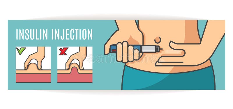 После инъекций инсулина пациент страдающий. Введение инсулина подкожно. Проведение инъекции инсулина. Рисунок укол инсулина.