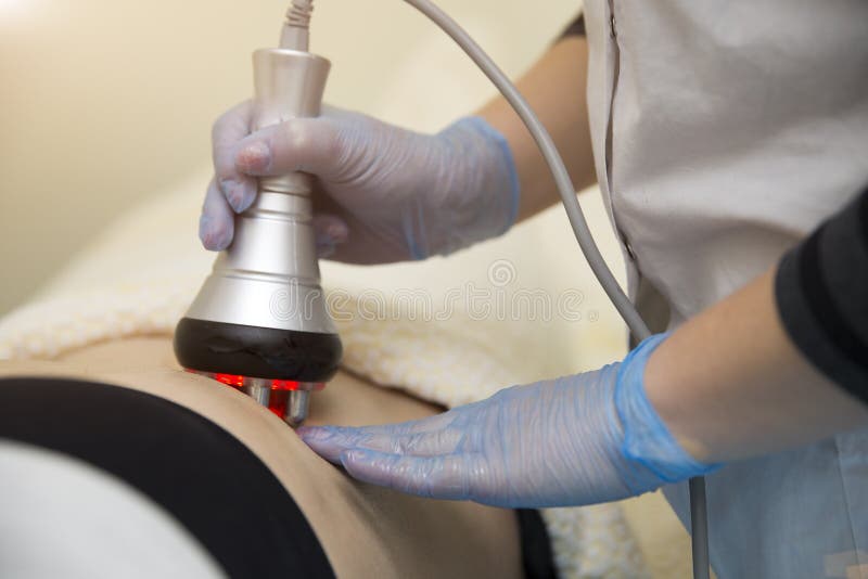 Bantning- och cellulitelaser-behandling på kliniken royaltyfria bilder Bantning- och cellulitelaser-behandling på kliniken royaltyfria bilder