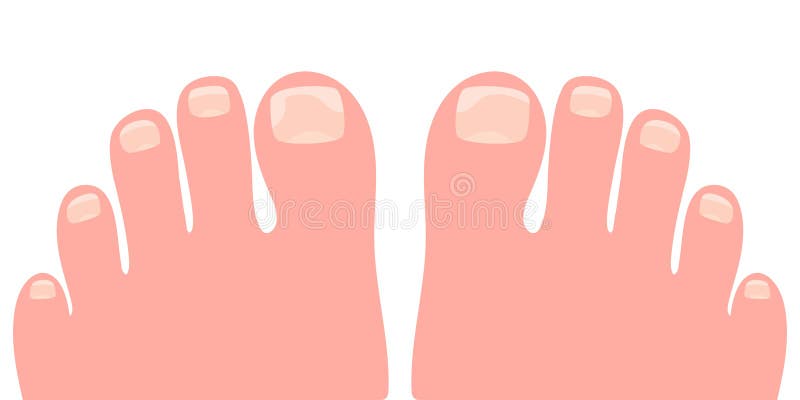 Bare Foots with Onycholysis on a Toenails Cartoon Vector Illustration ...