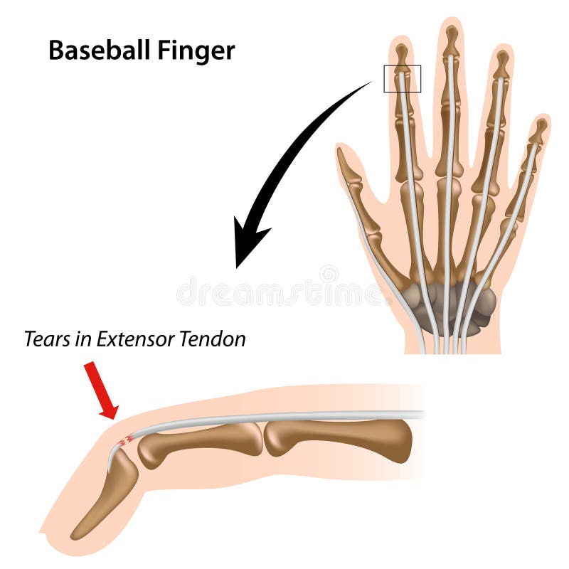 Baseball Finger Stock Image Image 23979931
