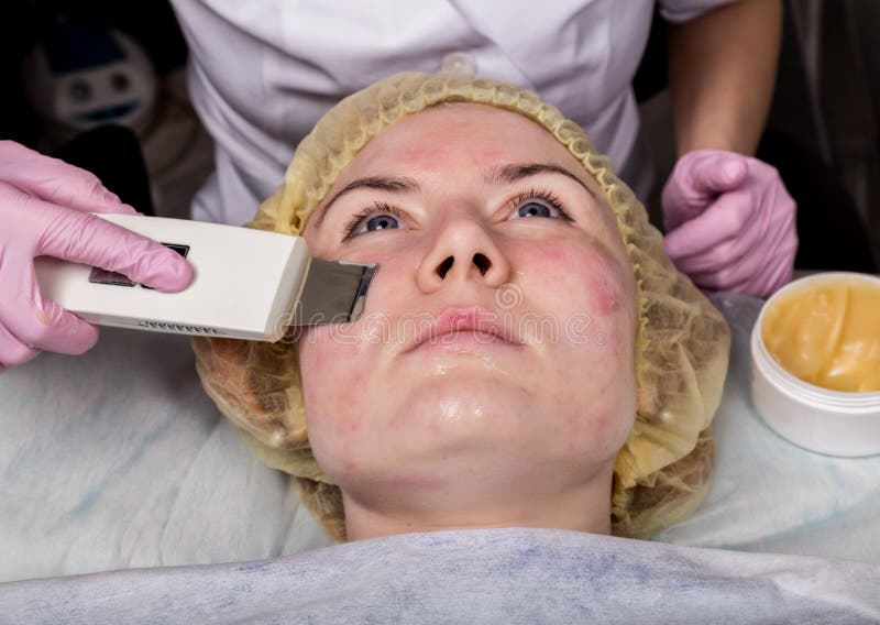 Beautician bei der Arbeit UltraschallgesichtsReinigungsverfahren f?r Problemhaut Studieren Sie die Reinigung, Sauerstoffs?ttigung lizenzfreies stockfoto Beautician bei der Arbeit UltraschallgesichtsReinigungsverfahren f?r Problemhaut Studieren Sie die Reinigung, Sauerstoffs?ttigung lizenzfreies stockfoto
