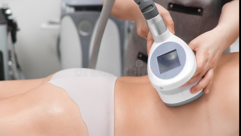 Beauticist con dispositivo de criolipolisis en nalgas de mujeres a cámara lenta almacen de video