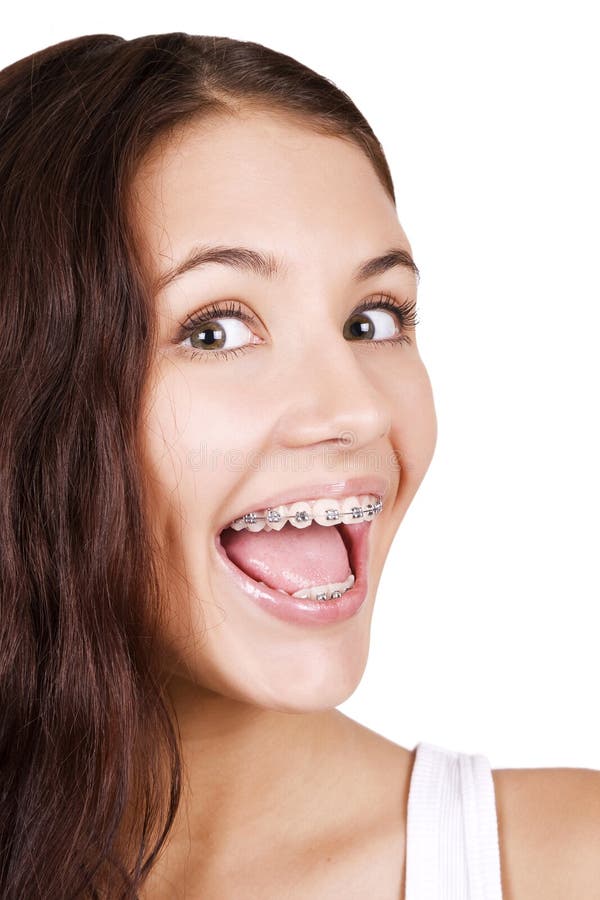 Beautiful girl with braces stock photo. Image of smile 16571956