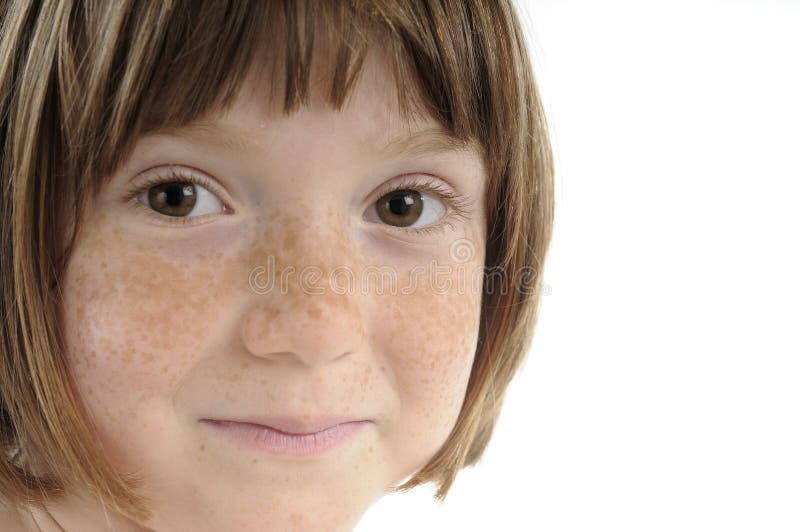 Beautiful skin of freckled girl