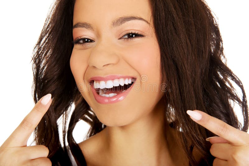 Smiling Woman with White Teeth Holding Teeth Whitening Tray Stock Photo