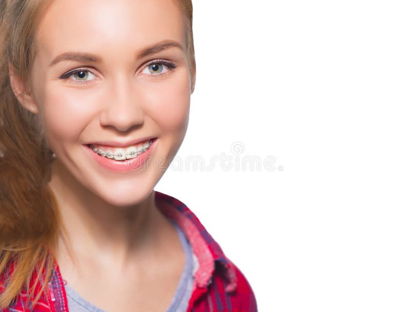 Portrait Teen Girl Showing Dental Braces Stock Photos - Download 134 ...