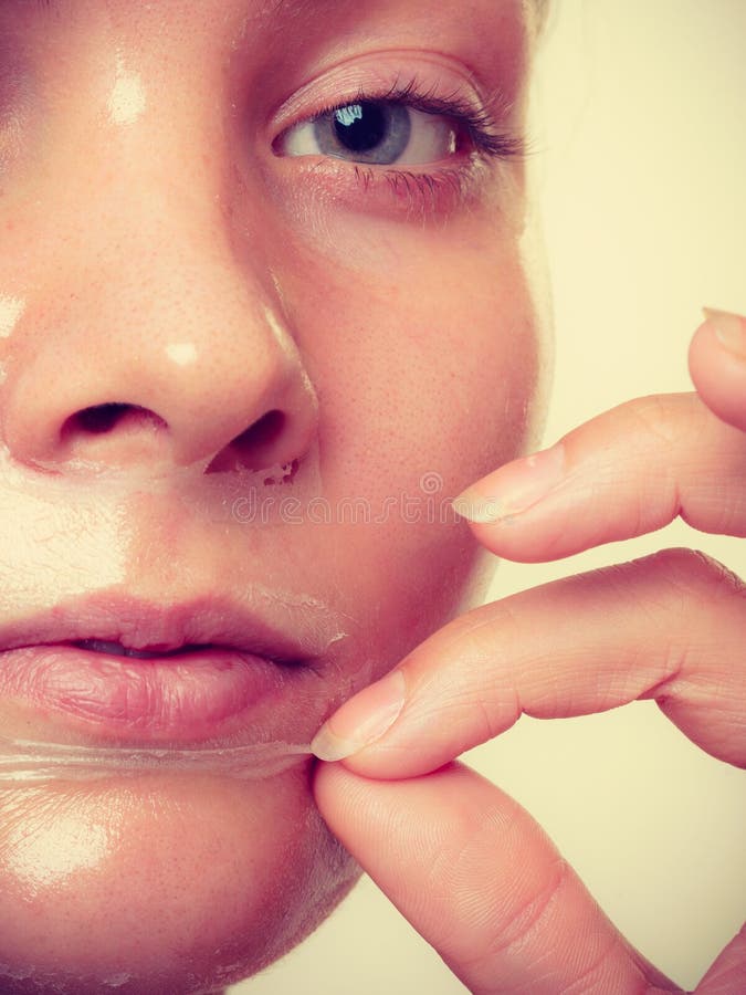 Woman Removing Facial Peel Off Mask Stock Image Image Of Face Condition 101767959