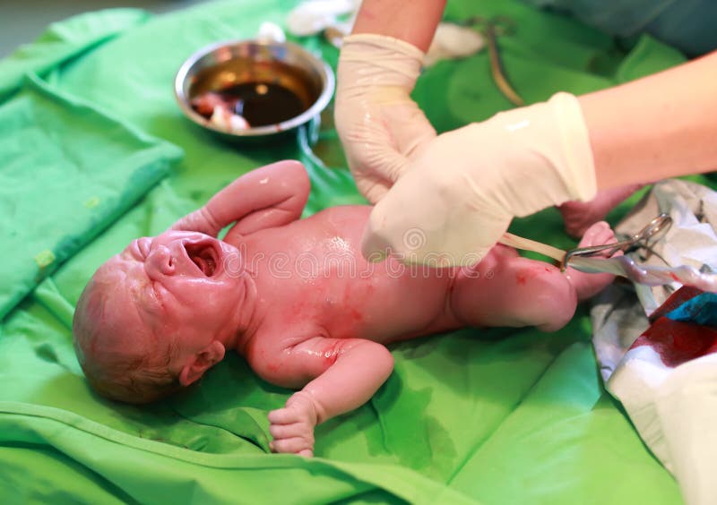 Bebê recém-nascido após o nascimento