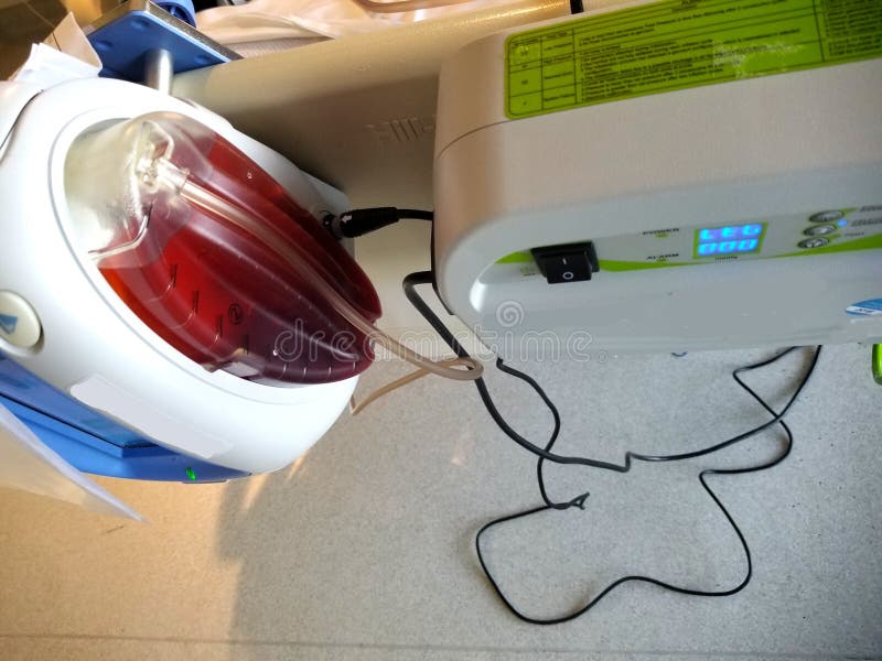 Bedside Vacuum Wound Reservoir with Serosanguinous Drainage Fluid Stock