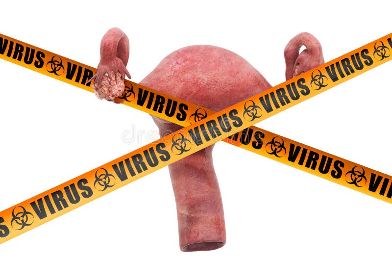 Begreppet Uterus-virus 3D-återgivning royaltyfri illustrationer
