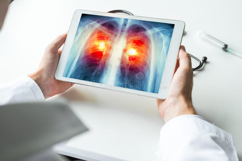 Doctor watching a xray of lung cancer on digital tablet. Radiology x-ray concept. Doctor watching a xray of lung cancer on digital tablet. Radiology x-ray concept