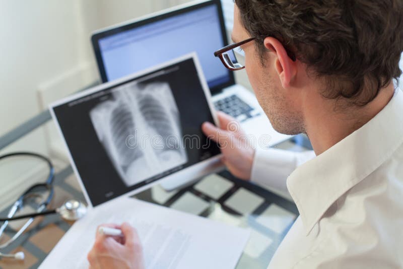 Behandeln Sie das Betrachten des Röntgenstrahls der Lungen, Krebsdiagnose