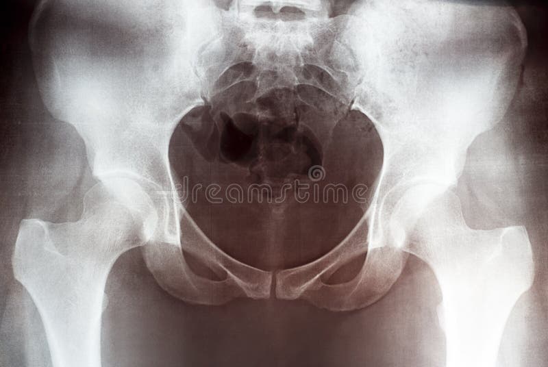 Behandschuhtes Handholding-Röntgenstrahlbild der weiblichen Pelvis, Vorderansicht lizenzfreie stockbilder Behandschuhtes Handholding-Röntgenstrahlbild der weiblichen Pelvis, Vorderansicht lizenzfreie stockbilder