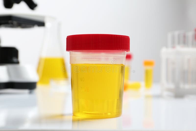 Container with urine sample for analysis on table in laboratory. Container with urine sample for analysis on table in laboratory