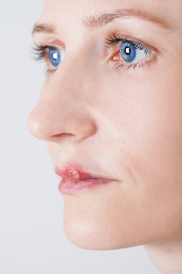 Bella donna con herpes infettato virus delle labbra immagini stock libere da diritti Bella donna con herpes infettato virus delle labbra immagini stock libere da diritti