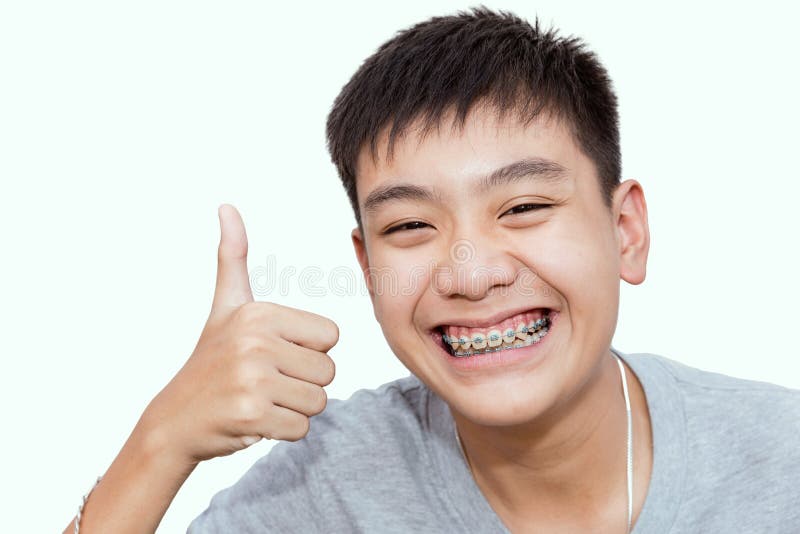 Bello sorridere del ragazzo bello con i denti rinforza dentario immagini stock libere da diritti Bello sorridere del ragazzo bello con i denti rinforza dentario immagini stock libere da diritti