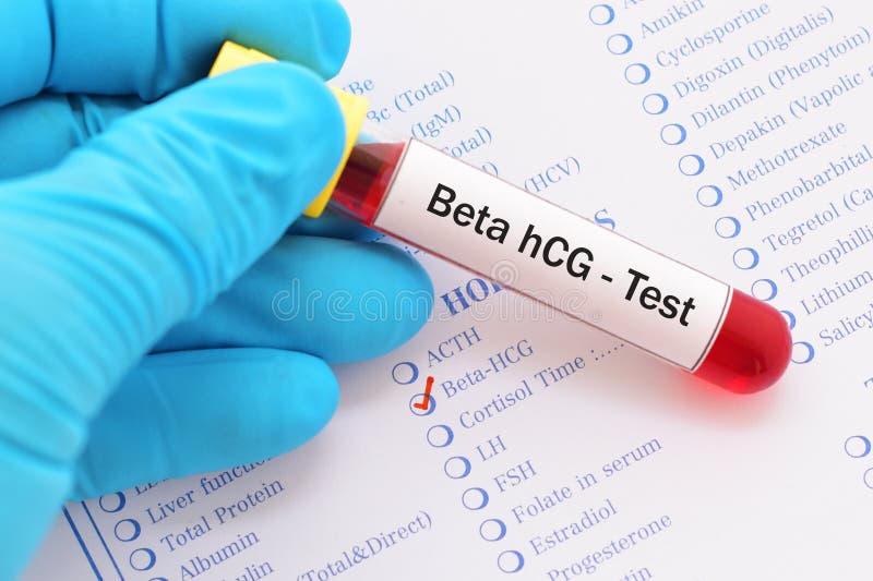 Beta teste do hCG foto de stock. Imagem de pesquisa - 101872948