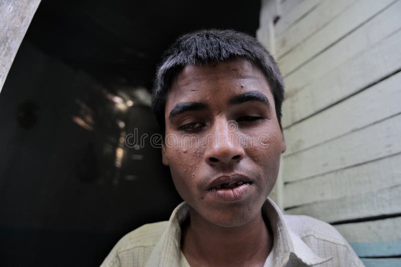 BHOPAL- DECEMBER 4: Salman Miyan who is blind from his birth allegedly due to toxic chemicals present in her mother's body outside his house in Bhopal - India on December 4, 2010.