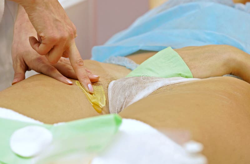 9 Types Of Bikini Waxes You Can Get - Bikini vs Brazilian Wax Styles