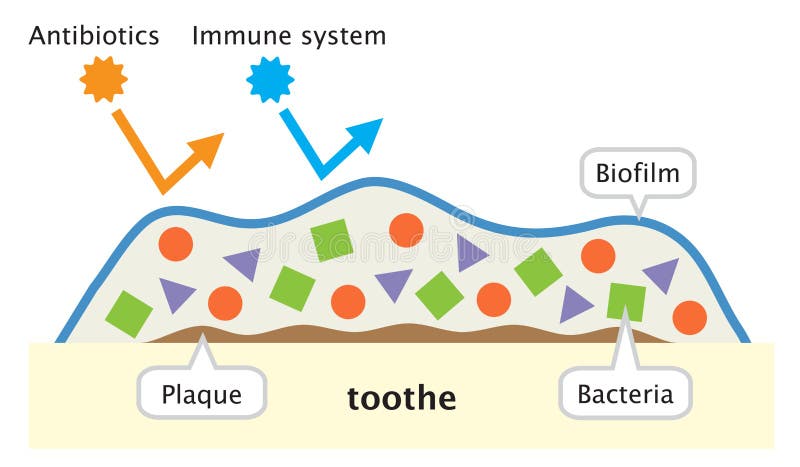 Biofilm on tooth illustration. dental and oral care concept