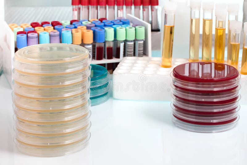 Biological Sample on the Workbench in the Microbiology Laboratory Stock