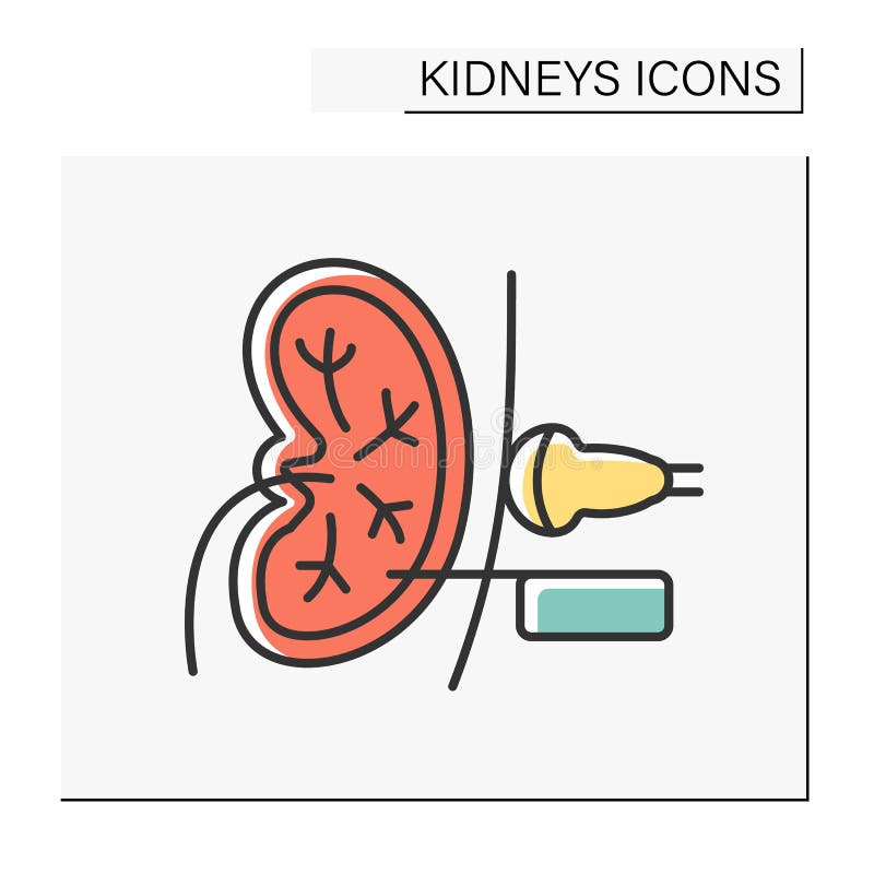 Kidney Biopsy Stock Illustrations – 48 Kidney Biopsy Stock Illustrations,  Vectors & Clipart - Dreamstime
