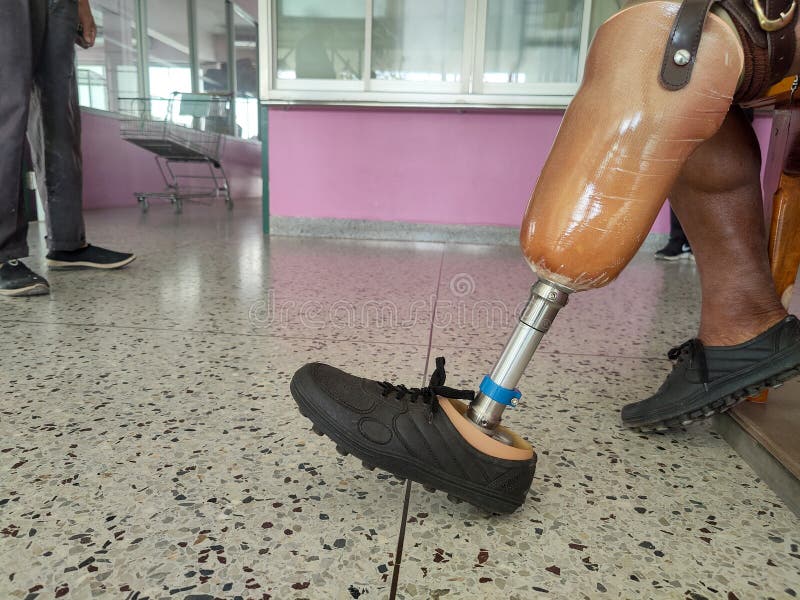 BK Disability Using and Training Leg Prothesis Stock Photo Image of