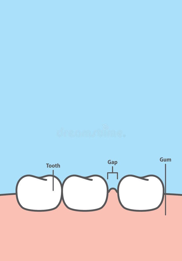 Teeth Gap Cartoon Stock Illustrations – 111 Teeth Gap Cartoon Stock Illustrations, Vectors & Clipart - Dreamstime Teeth Gap Cartoon Stock Illustrations – 111 Teeth Gap Cartoon Stock Illustrations, Vectors & Clipart - Dreamstime