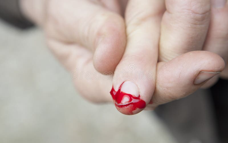 259 Bleeding Finger Stock Photos - Free & Royalty-Free Stock Photos from  Dreamstime