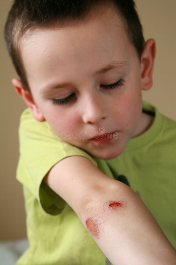 Bleeding injured boy stock photo. Image of scratch, care 9490900