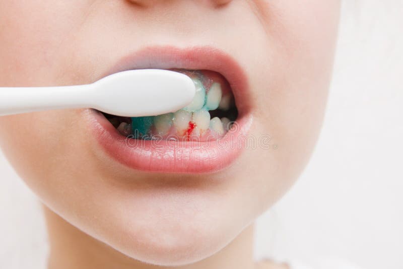 20,019 Bleeding Image Stock Photos - Free & Royalty-Free Stock Photos