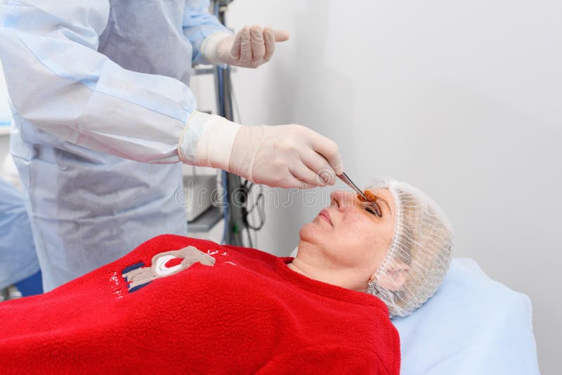Blepharoplasty, Plastic Surgery Operation for Correcting Defects