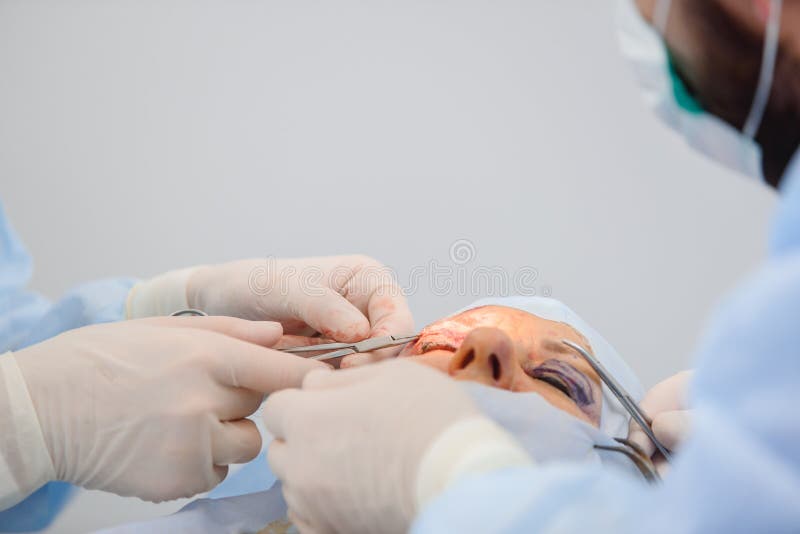 Blepharoplasty, Plastic Surgery Operation for Correcting Defects