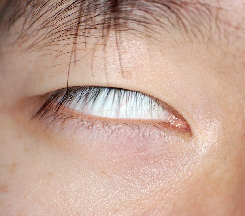 Blindes Auge ohne Pupille stockfoto. Bild von hell, schwarzes - 12161462